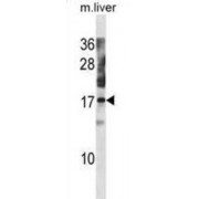 NTF2-Related Export Protein 1 (NXT1) Antibody