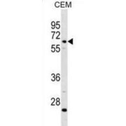 Complement Component 8, Beta Polypeptide (C8B) Antibody