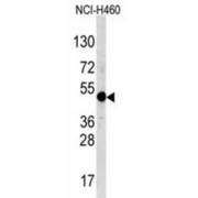 Transcription Factor AP-2 Alpha (TFAP2A) Antibody