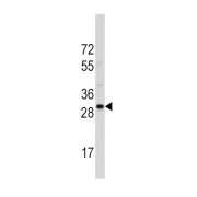 Ribosomal Protein S6 (RPS6) Antibody