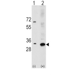 Ribosomal Protein S6 (RPS6) Antibody