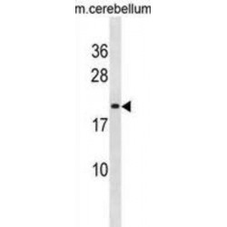 Vertebrate Lin-7 Homolog 2 (LIN7B) Antibody