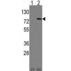RNA Polymerase-Associated Protein LEO1 (LEO1) Antibody