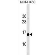 abx031219