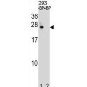 Apoptosis Regulator Bcl-2 (BCL2) Antibody