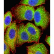 Transcription Factor p65 / NFKB3 (RELA) Antibody