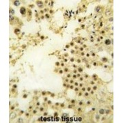 Zinc Finger Protein 219 (ZNF219) Antibody