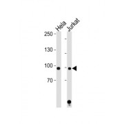 Signal Transducer And Activator of Transcription 1 (STAT1) Antibody