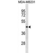 Tripartite Motif-Containing 51 (SPRYD5) Antibody
