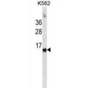 Hemoglobin Subunit Epsilon (HBE1) Antibody