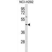 Thioredoxin-Interacting Protein (TXNIP) Antibody