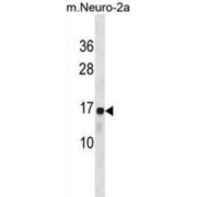 Ribosomal Protein L22 (RPL22) Antibody