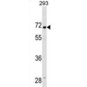 Leucine-Rich Repeat And Immunoglobulin-Like Domain-Containing Nogo Receptor-Interacting Protein 2 (LINGO2) Antibody