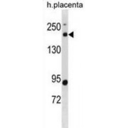 B-Cell CLL/Lymphoma 9 Like Protein (BCL9L) Antibody