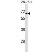 UDP-Glucuronosyltransferase 2B28 (UGT2B28) Antibody