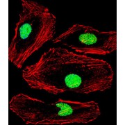 Methyl-CpG Binding Domain Protein 2 (MBD2) Antibody