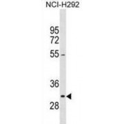 MKI67 FHA Domain-Interacting Nucleolar Phosphoprotein (MKI67IP) Antibody