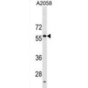 Ubiquitin Carboxyl-Terminal Hydrolase 14 (USP14) Antibody