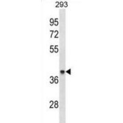 Acetyl-CoA Acetyltransferase 1 (ACAA1) Antibody