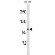 Netrin Receptor UNC5C (UNC5C) Antibody