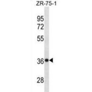 Cysteine And Histidine-Rich Domain-Containing Protein 1 (CHORDC1) Antibody