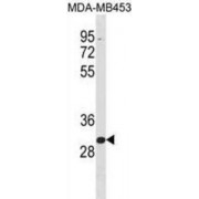 Zinc Finger Protein 367 (ZNF367) Antibody