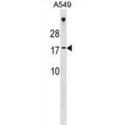 Protein SSX7 (SSX7) Antibody