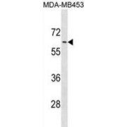 abx031294