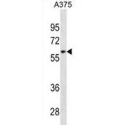 Zinc Finger Protein 394 (ZNF394) Antibody