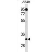 Complement C1q Tumor Necrosis Factor-Related Protein 2 (C1QTNF2) Antibody