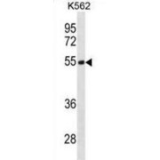 abx031304