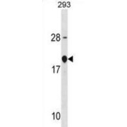 Eukaryotic Translation Initiation Factor 4E-Binding Protein 2 (EIF4EBP2) Antibody