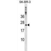 Frataxin (FXN) Antibody
