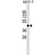 Protein Phosphatase, Mg2+/Mn2+ Dependent 1F (PPM1F) Antibody