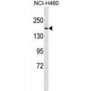 Synaptojanin-2 (SYNJ2) Antibody