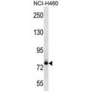 Fc Receptor-Like 3 (FCRL3) Antibody