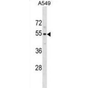 Pseudouridylate Synthase 10 (PUS10) Antibody