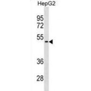 Sialidase-1 (NEU1) Antibody