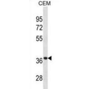 Alpha Tocopherol Transfer Protein (TTPA) Antibody