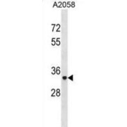 Tartrate-Resistant Acid Phosphatase 5 / TRACP5 (ACP5) Antibody
