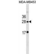 Claudin 14 (CLDN14) Antibody