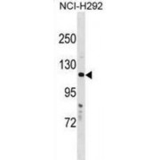 BLOC-2 Complex Member HPS5 (HPS5) Antibody