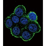 Bone Morphogenetic Protein Receptor 1A (BMPR1A) Antibody