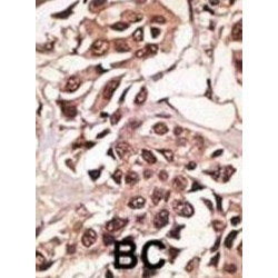 Bone Morphogenetic Protein Receptor 1A (BMPR1A) Antibody