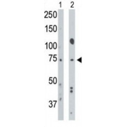 Bone Morphogenetic Protein Receptor 1A (BMPR1A) Antibody