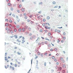 Bone Morphogenetic Protein Receptor 2 (BMPR2) Antibody