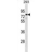 Poly ADP Ribose Polymerase 6 (PARP6) Antibody