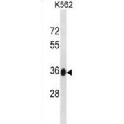 Methylmalonic Aciduria And Homocystinuria Type C Protein (MMACHC) Antibody