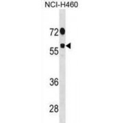 DEAD (Asp-Glu-Ala-Asp) Box Polypeptide 19B (DDX19B) Antibody