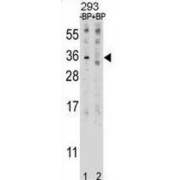 Interleukin-27 Subunit Beta (EBI3) Antibody